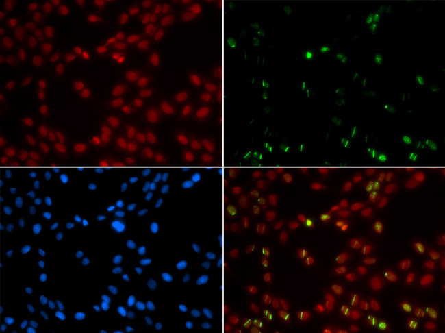 SUMO1 / SMT3 Antibody - Immunofluorescence analysis of GFP-RNF168 trangenic U2OS cells.