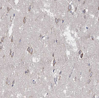 SUMO1 / SMT3 Antibody - 1:100 staining human brain tissue by IHC-P. The tissue was formaldehyde fixed and a heat mediated antigen retrieval step in citrate buffer was performed. The tissue was then blocked and incubated with the antibody for 1.5 hours at 22°C. An HRP conjugated goat anti-rabbit antibody was used as the secondary.