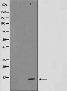 SUMO1 / SMT3 Antibody - Western blot analysis on 293 cell lysates using Sumo1 antibody. The lane on the left is treated with the antigen-specific peptide.