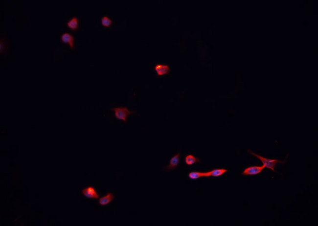 SUMO1 / SMT3 Antibody - Staining 293 cells by IF/ICC. The samples were fixed with PFA and permeabilized in 0.1% Triton X-100, then blocked in 10% serum for 45 min at 25°C. The primary antibody was diluted at 1:200 and incubated with the sample for 1 hour at 37°C. An Alexa Fluor 594 conjugated goat anti-rabbit IgG (H+L) Ab, diluted at 1/600, was used as the secondary antibody.