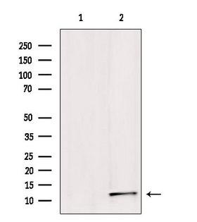SUMO1 / SMT3 Antibody - Western blot analysis of extracts of HepG2 cells using Sumo1 antibody. Lane 1 was treated with the blocking peptide.