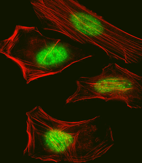 SUMO1 / SMT3 Antibody - Fluorescent confocal image of HeLa cell stained with Pan SUMO Antibody. HeLa cells were fixed with 4% PFA (20 min), permeabilized with Triton X-100 (0.1%, 10 min), then incubated with Pan SUMO primary antibody (1:25, 1 h at 37°C). For secondary antibody, Alexa Fluor 488 conjugated donkey anti-rabbit antibody (green) was used (1:400, 50 min at 37°C). Cytoplasmic actin was counterstained with Alexa Fluor 555 (red) conjugated Phalloidin (7units/ml, 1 h at 37°C). Nuclei were counterstained with DAPI (blue) (10 ug/ml, 10 min). Pan SUMO immunoreactivity is localized to Nucleus significantly.