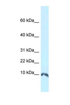 SUMO1 / SMT3 Antibody - SUMO1 antibody Western blot of Mouse Thymus lysate. Antibody concentration 1 ug/ml.  This image was taken for the unconjugated form of this product. Other forms have not been tested.