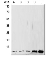 SUMO1 / SMT3 Antibody - Western blot analysis of SUMO1 expression in MCF7 (A); A431 (B); HeLa (C); mouse kidney (D); rat kidney (E) whole cell lysates.