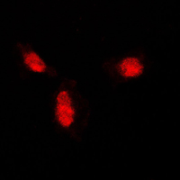 SUMO1 / SMT3 Antibody - Immunofluorescent analysis of SUMO1 staining in A431 cells. Formalin-fixed cells were permeabilized with 0.1% Triton X-100 in TBS for 5-10 minutes and blocked with 3% BSA-PBS for 30 minutes at room temperature. Cells were probed with the primary antibody in 3% BSA-PBS and incubated overnight at 4 C in a humidified chamber. Cells were washed with PBST and incubated with a DyLight 594-conjugated secondary antibody (red) in PBS at room temperature in the dark. DAPI was used to stain the cell nuclei (blue).