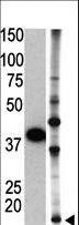 SUMO2 Antibody - The SUMO2 C-term Antibody is used in Western blot to detect SUMO2 in GST-SUMO2 fusion protein (lane 1) and HL60 cell lysate (lane 2).