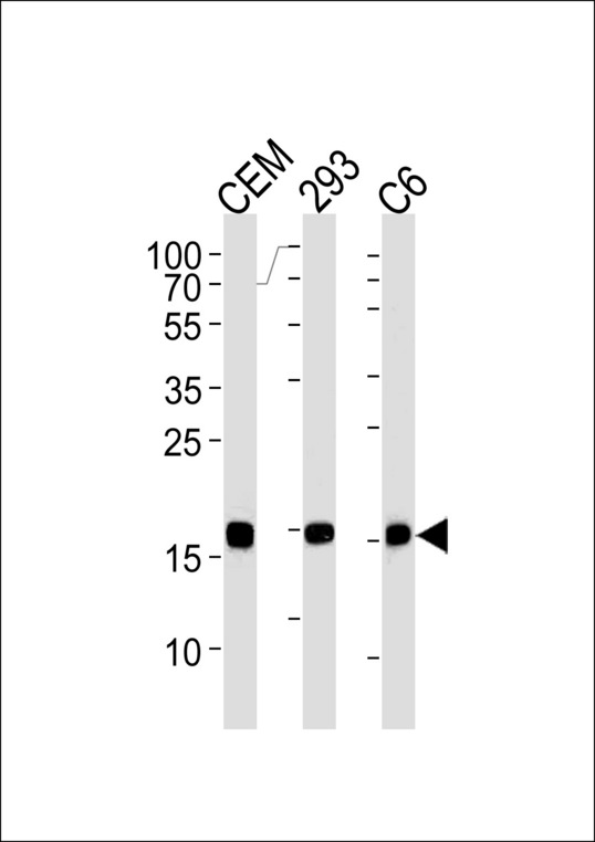 SUMO2 Antibody - SUMO2 Antibody western blot of CEM,293,rat C6 cell line lysates (35 ug/lane). The SUMO2 antibody detected the SUMO2 protein (arrow).