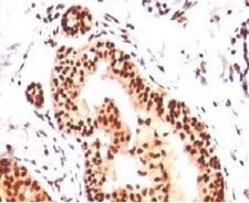 SUMO2 Antibody - IHC analysis of human tonsil with SUMO2/3 antibody (clone S23MT-1).  This image was taken for the unmodified form of this product. Other forms have not been tested.