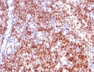 SUMO2 Antibody - Formalin-fixed, paraffin-embedded rat ovary stained with SUMO-2 antibody.  This image was taken for the unmodified form of this product. Other forms have not been tested.