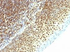 SUMO2 Antibody - Formalin-fixed, paraffin-embedded human tonsil stained with SUMO2 antibody (SPM621).  This image was taken for the unmodified form of this product. Other forms have not been tested.