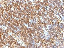 SUMO2 Antibody - Formalin-fixed, paraffin-embedded human tonsil stained with SUMO-2 antibody (SUMO2/1199).  This image was taken for the unmodified form of this product. Other forms have not been tested.
