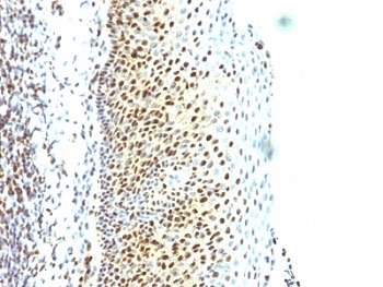 SUMO2 Antibody - Formalin-fixed, paraffin-embedded human tonsil stained with SUMO-2 antibody.  This image was taken for the unmodified form of this product. Other forms have not been tested.