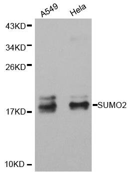 SUMO2 Antibody - Western blot analysis of extracts of various cell lines.