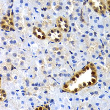 SUMO2 Antibody - Immunohistochemistry of paraffin-embedded rat kidney tissue.