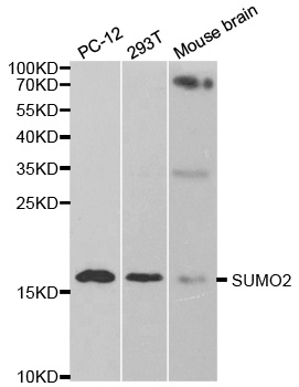 SUMO2 Antibody - Western blot analysis of extracts of various cell lines, using SUMO2 antibody.