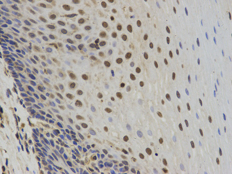 SUMO2 Antibody - Immunohistochemistry of paraffin-embedded human esophagus using SUMO2 antibody at dilution of 1:100 (200x lens).