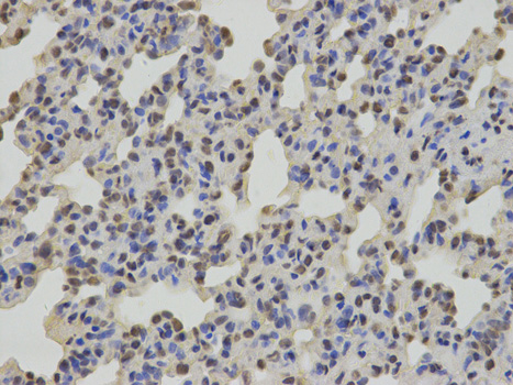 SUMO2 Antibody - Immunohistochemistry of paraffin-embedded rat lung using SUMO2 antibody at dilution of 1:100 (400x lens).