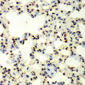 SUMO2 Antibody - Immunohistochemistry of paraffin-embedded rat lung using SUMO2 antibody at dilution of 1:100 (40x lens).
