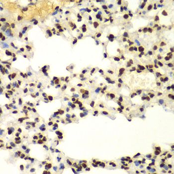 SUMO2 Antibody - Immunohistochemistry of paraffin-embedded mouse lung using SUMO2 antibody at dilution of 1:100 (40x lens).