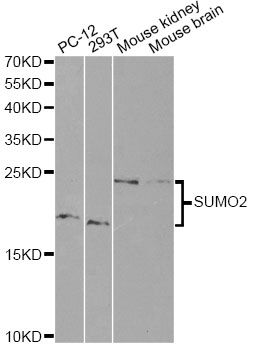 SUMO2 Antibody - Western blot analysis of extracts of various cell lines, using SUMO2 antibody at 1:1000 dilution. The secondary antibody used was an HRP Goat Anti-Rabbit IgG (H+L) at 1:10000 dilution. Lysates were loaded 25ug per lane and 3% nonfat dry milk in TBST was used for blocking.