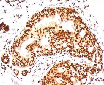 SUMO2 + SUMO3 Antibody - SUMO2/3 antibody SM23/496 immunohistochemistry tonsil.  This image was taken for the unmodified form of this product. Other forms have not been tested.