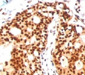 SUMO2 + SUMO3 Antibody - IHC staining of human tonsil with SUMO2/3 antibody (SM23/496)