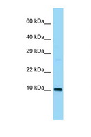 SUMO3 Antibody - SUMO3 antibody Western blot of Mouse Heart lysate. Antibody concentration 1 ug/ml.  This image was taken for the unconjugated form of this product. Other forms have not been tested.