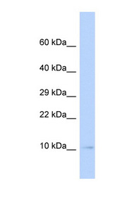 SUMO3 Antibody - SUMO3 antibody Western blot of MCF7 cell lysate. This image was taken for the unconjugated form of this product. Other forms have not been tested.