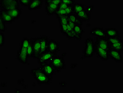 SUMO3 Antibody - Immunofluorescent analysis of Hela cells diluted at 1:100 and Alexa Fluor 488-congugated AffiniPure Goat Anti-Rabbit IgG(H+L)