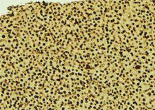 SUMO3 Antibody - 1:100 staining mouse liver tissue by IHC-P. The sample was formaldehyde fixed and a heat mediated antigen retrieval step in citrate buffer was performed. The sample was then blocked and incubated with the antibody for 1.5 hours at 22°C. An HRP conjugated goat anti-rabbit antibody was used as the secondary.