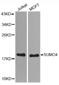 SUMO4 Antibody - Western blot analysis of extracts of various cell lines.