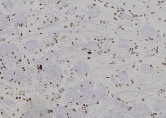 SUMO4 Antibody - 1:100 staining rat brain tissue by IHC-P. The sample was formaldehyde fixed and a heat mediated antigen retrieval step in citrate buffer was performed. The sample was then blocked and incubated with the antibody for 1.5 hours at 22°C. An HRP conjugated goat anti-rabbit antibody was used as the secondary.