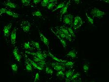 SUMO4 Antibody - Immunofluorescence staining of SUMO4 in U251MG cells. Cells were fixed with 4% PFA, permeabilzed with 0.1% Triton X-100 in PBS, blocked with 10% serum, and incubated with rabbit anti-Human SUMO4 polyclonal antibody (dilution ratio 1:200) at 4°C overnight. Then cells were stained with the Alexa Fluor 488-conjugated Goat Anti-rabbit IgG secondary antibody (green). Positive staining was localized to Nucleus and cytoplasm.