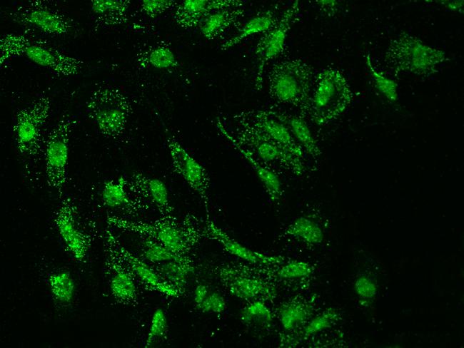 SUMO4 Antibody - Immunofluorescence staining of SUMO4 in U251MG cells. Cells were fixed with 4% PFA, permeabilzed with 0.1% Triton X-100 in PBS, blocked with 10% serum, and incubated with rabbit anti-Human SUMO4 polyclonal antibody (dilution ratio 1:200) at 4°C overnight. Then cells were stained with the Alexa Fluor 488-conjugated Goat Anti-rabbit IgG secondary antibody (green). Positive staining was localized to Nucleus and cytoplasm.
