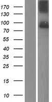 SUN1 Protein - Western validation with an anti-DDK antibody * L: Control HEK293 lysate R: Over-expression lysate