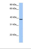 SUNC1 / SUN3 Antibody - HepG2 cell lysate. Antibody concentration: 1.0 ug/ml. Gel concentration: 12%.  This image was taken for the unconjugated form of this product. Other forms have not been tested.
