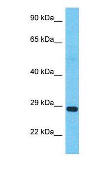 SUNC1 / SUN3 Antibody - Western blot of SUN3 Antibody with human Uterus Tumor lysate.  This image was taken for the unconjugated form of this product. Other forms have not been tested.