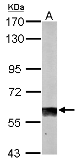 SUOX / Sulfite Oxidase Antibody - Sample (50 ug of whole cell lysate). A: mouse liver. 7.5% SDS PAGE. Sulfite Oxidase / SUOX antibody diluted at 1:1000.