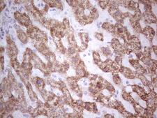 SUOX / Sulfite Oxidase Antibody - Immunohistochemical staining of paraffin-embedded Human liver tissue within the normal limits using anti-SUOX mouse monoclonal antibody. (Heat-induced epitope retrieval by 1 mM EDTA in 10mM Tris, pH8.5, 120C for 3min,