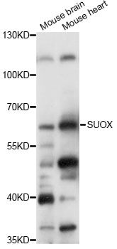 SUOX / Sulfite Oxidase Antibody - Western blot analysis of extracts of various cell lines, using SUOX antibody at 1:1000 dilution. The secondary antibody used was an HRP Goat Anti-Rabbit IgG (H+L) at 1:10000 dilution. Lysates were loaded 25ug per lane and 3% nonfat dry milk in TBST was used for blocking. An ECL Kit was used for detection and the exposure time was 1s.