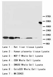 Superoxide Dismutase Antibody -  This image was taken for the unconjugated form of this product. Other forms have not been tested.