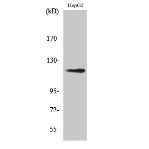 SUPT16H / FACTP140 Antibody - Western blot of SPT16 antibody