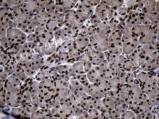 SUPT16H / FACTP140 Antibody - Immunohistochemical staining of paraffin-embedded Human pancreas tissue within the normal limits using anti-SUPT16H mouse monoclonal antibody. (Heat-induced epitope retrieval by 1mM EDTA in 10mM Tris buffer. (pH8.5) at 120°C for 3 min. (1:150)