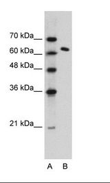 SUPT16H / FACTP140 Antibody - Jurkat Cell Lysate.  This image was taken for the unconjugated form of this product. Other forms have not been tested.