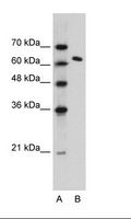 SUPT16H / FACTP140 Antibody - Jurkat Cell Lysate.  This image was taken for the unconjugated form of this product. Other forms have not been tested.