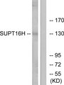 SUPT16H / FACTP140 Antibody - Western blot analysis of lysates from HepG2 and Jurkat cells, using SUPT16H Antibody. The lane on the right is blocked with the synthesized peptide.