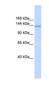 SUPT16H / FACTP140 Antibody - SUPT16H antibody Western blot of 293T cell lysate. This image was taken for the unconjugated form of this product. Other forms have not been tested.