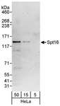 SUPT16H / FACTP140 Antibody - Detection of Human Spt16 by Western Blot. Samples: Whole cell lysate (5, 15 and 50 ug) from HeLa cells. Antibodies: Affinity purified rabbit anti-Spt16 antibody used at 0.1 ug/ml. Detection: Chemiluminescence with an exposure time of 3 minutes.