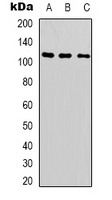 SUPT16H / FACTP140 Antibody - Western blot analysis of SUPT16H expression in HeLa (A); A549 (B); Jurkat (C) whole cell lysates.