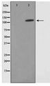 SUPT16H / FACTP140 Antibody - Western blot of HepG2 cell lysate using SUPT16H Antibody